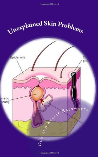 Unexplained Skin Problems: Home Treatment And Precautions