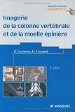Imagerie de la colonne vert�brale et de la moelle �pini�re