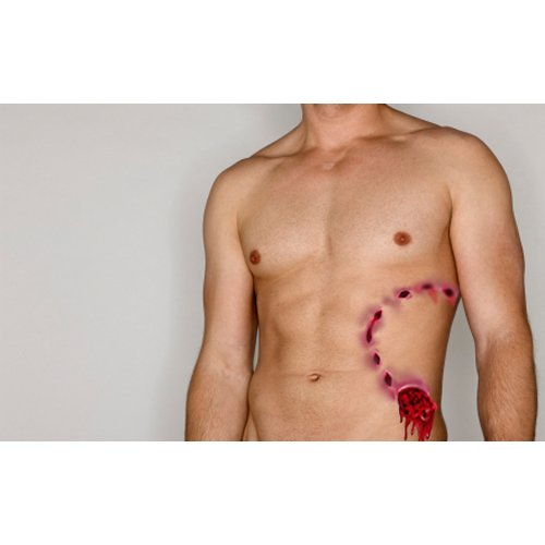 Bleeding Reef Shark Bite Temporary Tattoo Pack - 1 2pc Bite Wound Tattoo Per Pack Bleeding Reef Shark Bite Temporary Tattoo Pack - 1 2pc Bite Wound Tattoo Per Pack