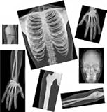 Human X-Rays on Film