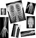 Human X-Rays on Film