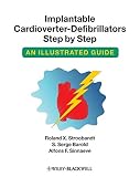 Implantable cardioverter-defibrillators step by step : an illustrated guide