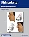 Rhinoplasty: Cases and Techniques