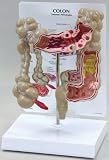 Human Colon Model