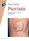 Psoriasis
