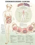 Understanding Cancer Anatomical Chart