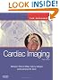 Cardiac Imaging: The Requisites, 3e (Requisites in Radiology)