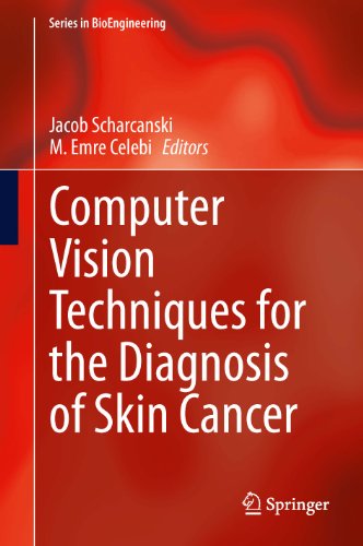 Computer Vision Techniques for the Diagnosis of Skin Cancer (Series in BioEngineering)From Springer