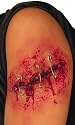 Safely Pinned 4 Inch Gash