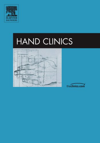 Hand Arthritis, An Issue of Hand Clinics 41joZktsgXL Hand Arthritis, An Issue of Hand Clinics