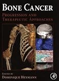 Bone Cancer: Progression and Therapeutic Approaches
