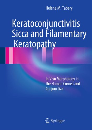 Keratoconjunctivitis Sicca and Filamentary Keratopathy: In Vivo Morphology in the Human Cornea and Conjunctiva