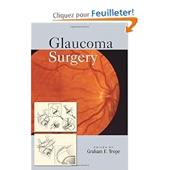 Glaucoma Surgery