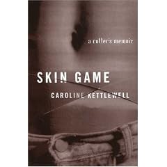 Skin Game: A Memoir