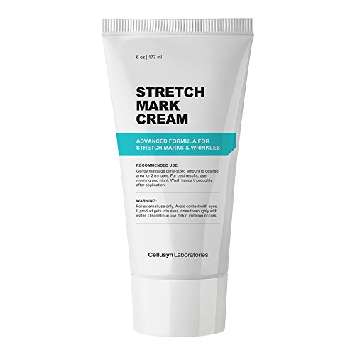 cream for white stretch marks