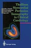 Thallium myocardial perfusion tomography in clinical cardiology