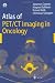 Atlas of PET/CT Imaging in Oncology