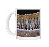 Cochlea cells, SEM Photo Mugs