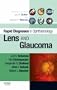 Rapid Diagnosis in Ophthalmology Series: Lens and Glaucoma, 1e (Rapid Diagnoses in Ophthalmology)
