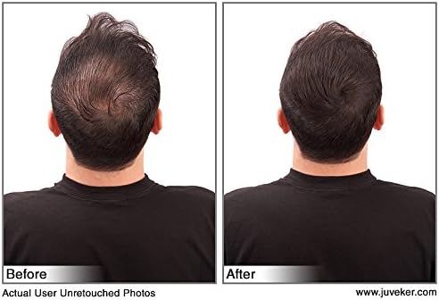 Juveker Hair Building Fibers for Men & Women - 28 Grams (Net Wt .98oz)