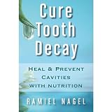 Cure Tooth Decay: Heal And Prevent Cavities With Nutrition - Limit And Avoid Dental Surgery and Fluoride
