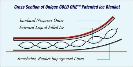 Forearm Arm Ice Wrap by Cold One