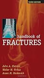 ISBN 9780071443777 product image for Handbook of Fractures, Third Edition | upcitemdb.com
