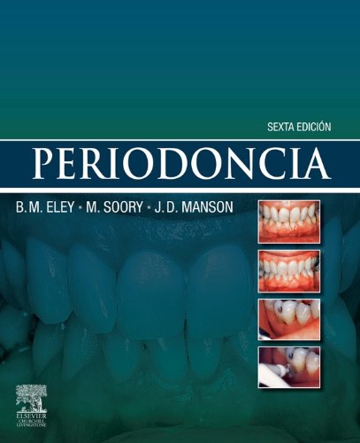 Periodoncia (Spanish Edition)