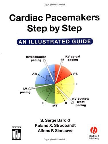 Cardiac Pacemakers Step-by-Step: An Illustrated Guide