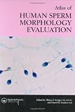 Atlas of Human Sperm Morphology Evaluation