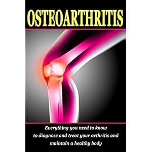 Osteoarthritis: Everything you need to know to diagnose and treat your arthritis and how to maintain a healthy body