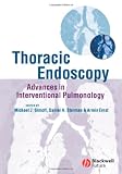 Thoracic Endoscopy: Advances in Interventional Pulmonology