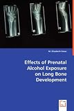 Effects on Prenatal Alcohol Exposure on Long Bone Development
