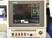 GE Marquette Eagle 4000 Vital Signs Patient Monitor with ECG NIBP SPO2