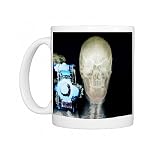 Person with a camera, X-ray Photo Mugs