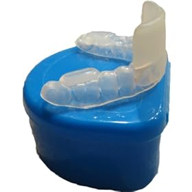 Stop Snoring Snore Sleep Apnea Anti Snoring Device Custom Fitted ProSnore Snore Appliance