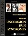 Atlas of Uncommon Pain Syndromes: Text with Image Bank CD-ROM, 2e