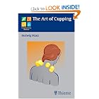 The Art of Cupping (Complementary Medicine (Thieme Paperback)) by Hedwig Manz