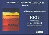 Atlas d'�lectroenc�phalographie : Tome I : EEG de veille et de sommeil. Sensibilisation et artefacts