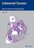 Histopathology of Colorectal Tumors