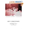 My Lobotomy