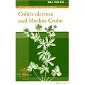 Was tun bei Colitis ulcerosa und Morbus Crohn: Naturheilkunde und Intergrative Medizin