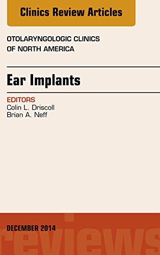 Ear Implants, An Issue of Otolaryngologic Clinics of North America, (The Clinics: Internal Medicine)