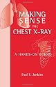 Making Sense of the Chest X-ray: A Hands-on Guide (Hodder Arnold Publication)