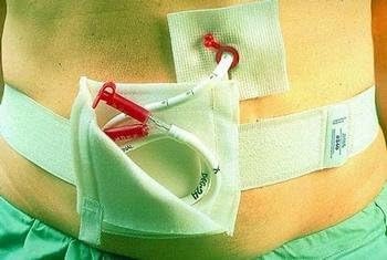 G-Tube Holder - 1 box (10 Each)