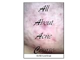 All About Acne (Dermatology)