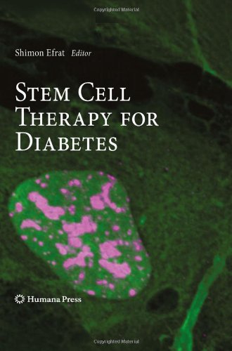 stem cell therapy for diabetes stem cell biology and regenerative medicine