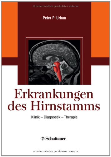 Erkrankungen des Hirnstamms: Klinik - Diagnostik - Therapie 3794524780 pdf