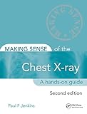 Making sense of the chest X-ray : a hands-on guide