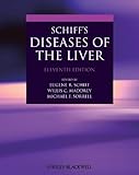 Schiff's diseases of the liver